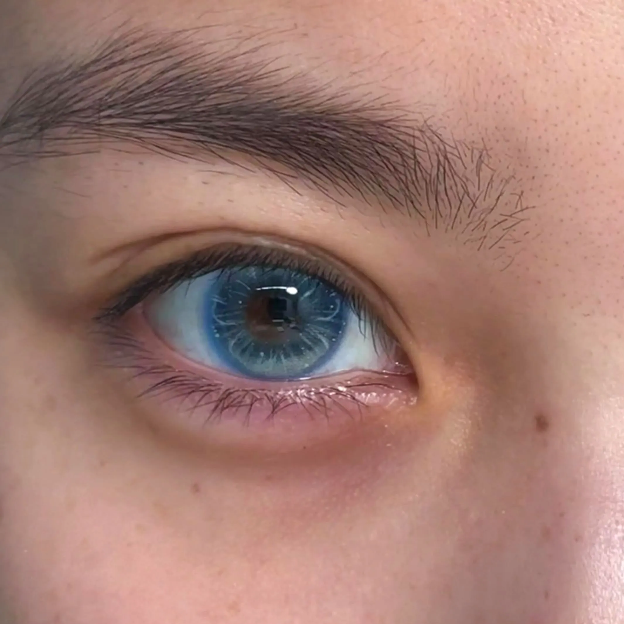 EyeLensy Jellyfish Glow Blue Έγχρωμοι Φακοί Επαφής 6 Μήνες