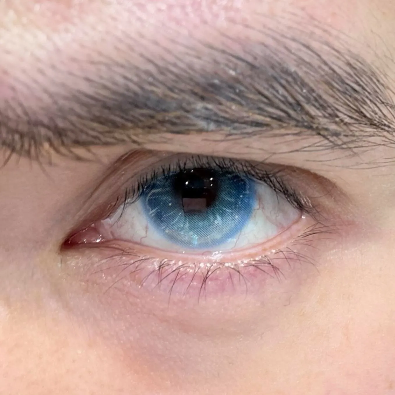 EyeLensy Jellyfish Glow Blue Έγχρωμοι Φακοί Επαφής 6 Μήνες